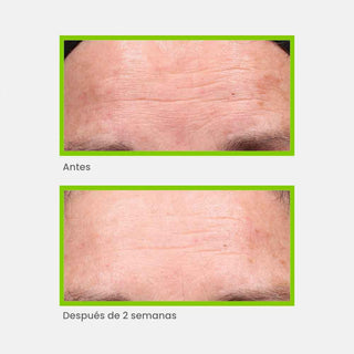 Murad Antiedad Retinol Youth Renewal Serum 30ml