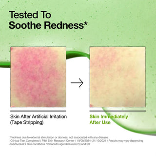 Anua Azelaic Acid 10 Hyaluron Redness Soothing Sérum 30ml