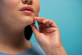 ¿Labios agrietados? Por qué lamerse es lo peor que puedes hacer