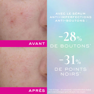Nuxe Zinc Power Sérum Anti-imperfecciones 30ml
