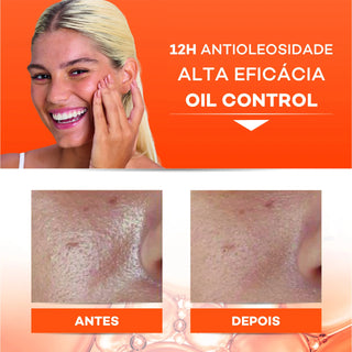 Darrow Actine Oil Control Gel De Limpieza 140g