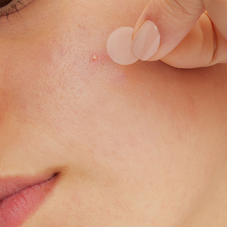 Cerave Parches Control de Imperfecciones 22 piezas