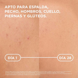 Bioderma Sébium Kerato+ Body Tratamiento Antiimperfecciones Corporal 150ml