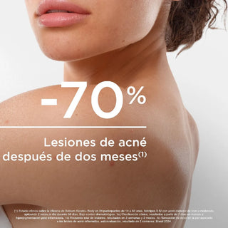 Bioderma Sébium Kerato+ Body Tratamiento Antiimperfecciones Corporal 150ml