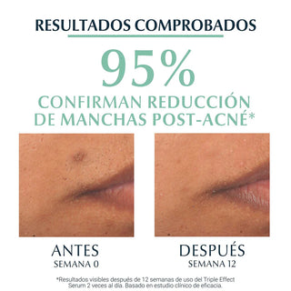 Eucerin Dermopure Oil Control Triple Efect Serum 40ml