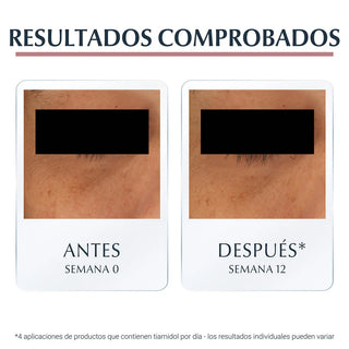 Eucerin Antipigment Contornos De Ojos 15ml