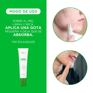 Trioximed Spot Antiacné Corrector Localizado 15g
