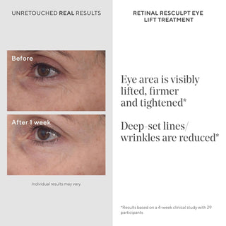 Murad Retinal ReSculpt Eye Treatment 15ml