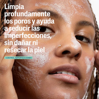 Cetaphil Oil Control Limpiador Facial Control Imperfecciones 236ml
