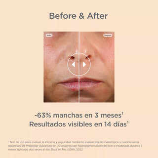 Isdin Isdinceutics Melaclear Advance Sérum 30ml