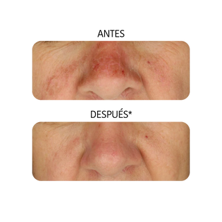 Iroha Nature Mascarilla Facial Hidratante Tisu De Aloe Vera 1 Unidad