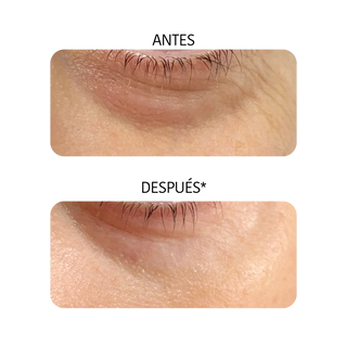 Iroha Nature Parches De Ojos Niacinamida Cafeìna Y Peptidos